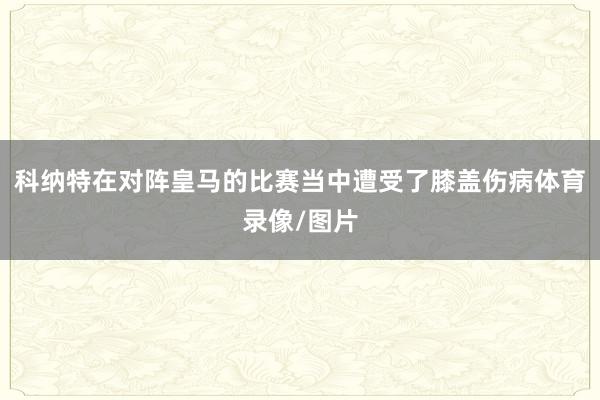 科纳特在对阵皇马的比赛当中遭受了膝盖伤病体育录像/图片